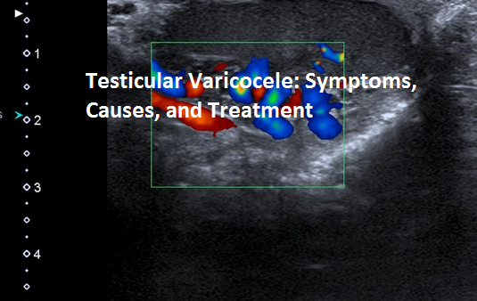 Testicular Varicocele: Symptoms, Causes, And Treatment
