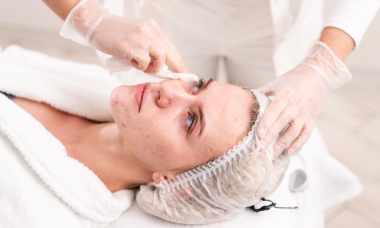 Laser Treatments