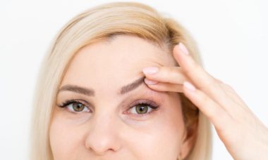 lift drooping eyelids