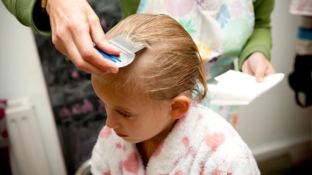 how to treat lice in your hair