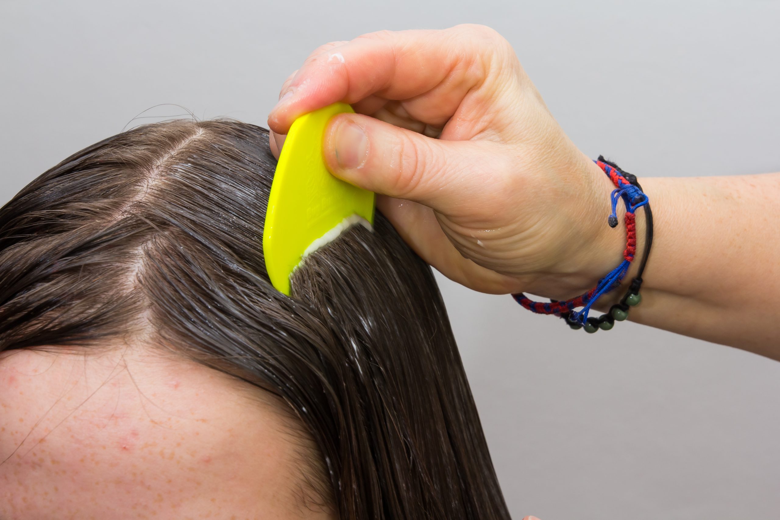 wet combing to remove lice in hair